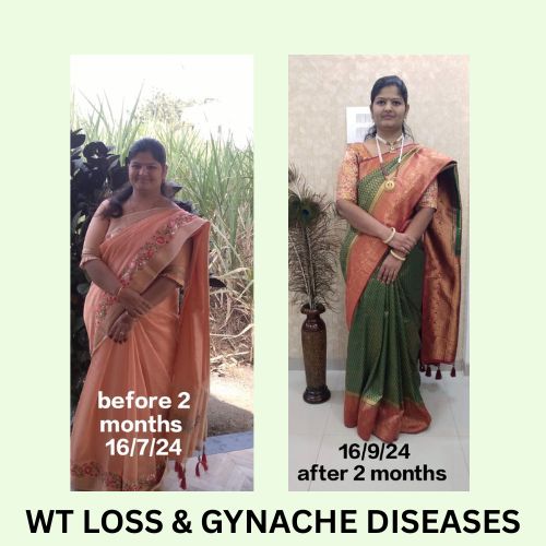 wt loss gyn g